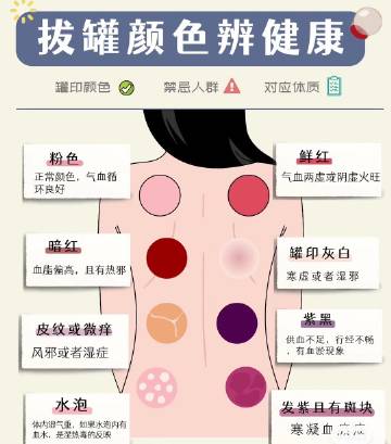 拔罐颜色深浅与体内毒素关系揭秘，真相解析