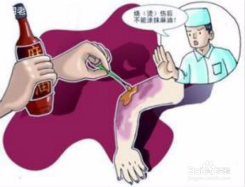 小儿跌倒后的急救与应急处理指南