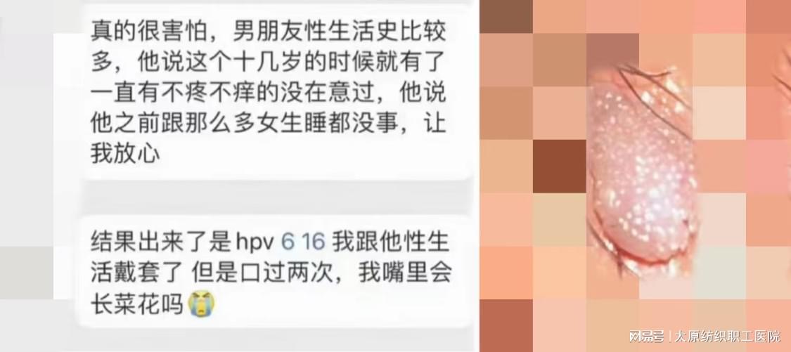 女性尖疣症状图片详解及相关探讨