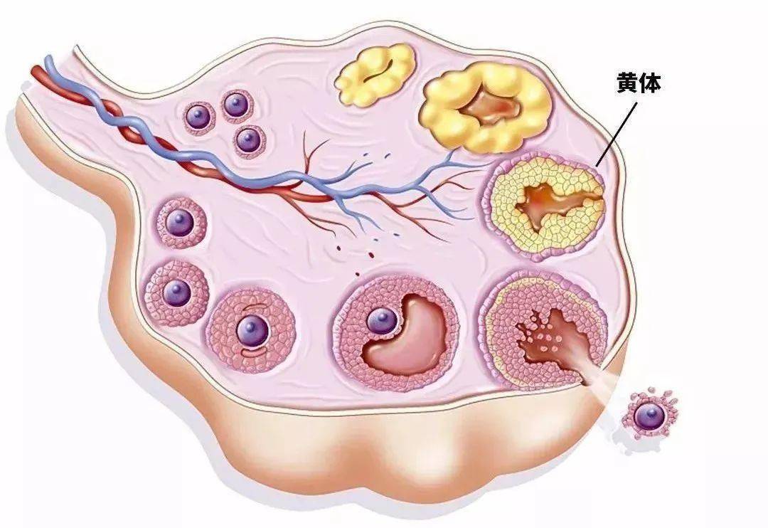 夫妻玩闹引发妻子黄体破裂，症状、原因与预防措施