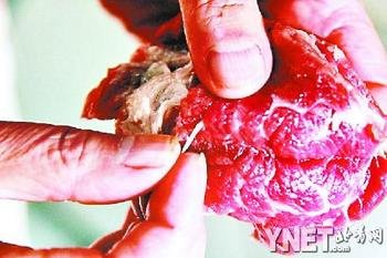 美国男子因食用未煮熟猪肉感染虫卵，食品安全意识敲响警钟